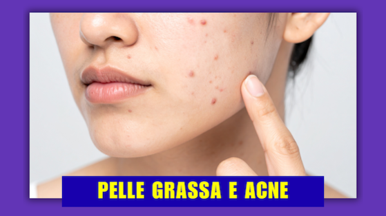 corso acne e pelle grassa